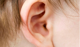 Outer view of ear - the tympanostomy tube is not visible