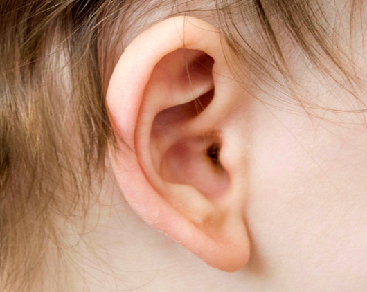 Outer view of ear - the tympanostomy tube is not visible